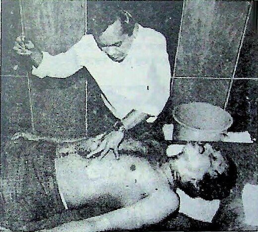 পেটে অস্ত্রোপচারের মুহূর্তে