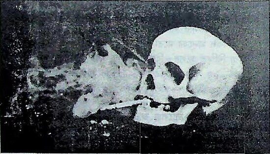 নরমুণ্ড সিগারেট টানছে