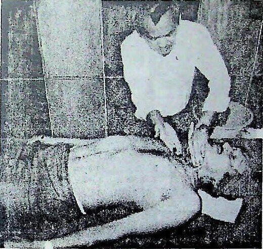 লেখকের গলায় অস্ত্রোপচার করে গ্যালার্ডো বের করলেন কালচেলাল থকথকে কিছু